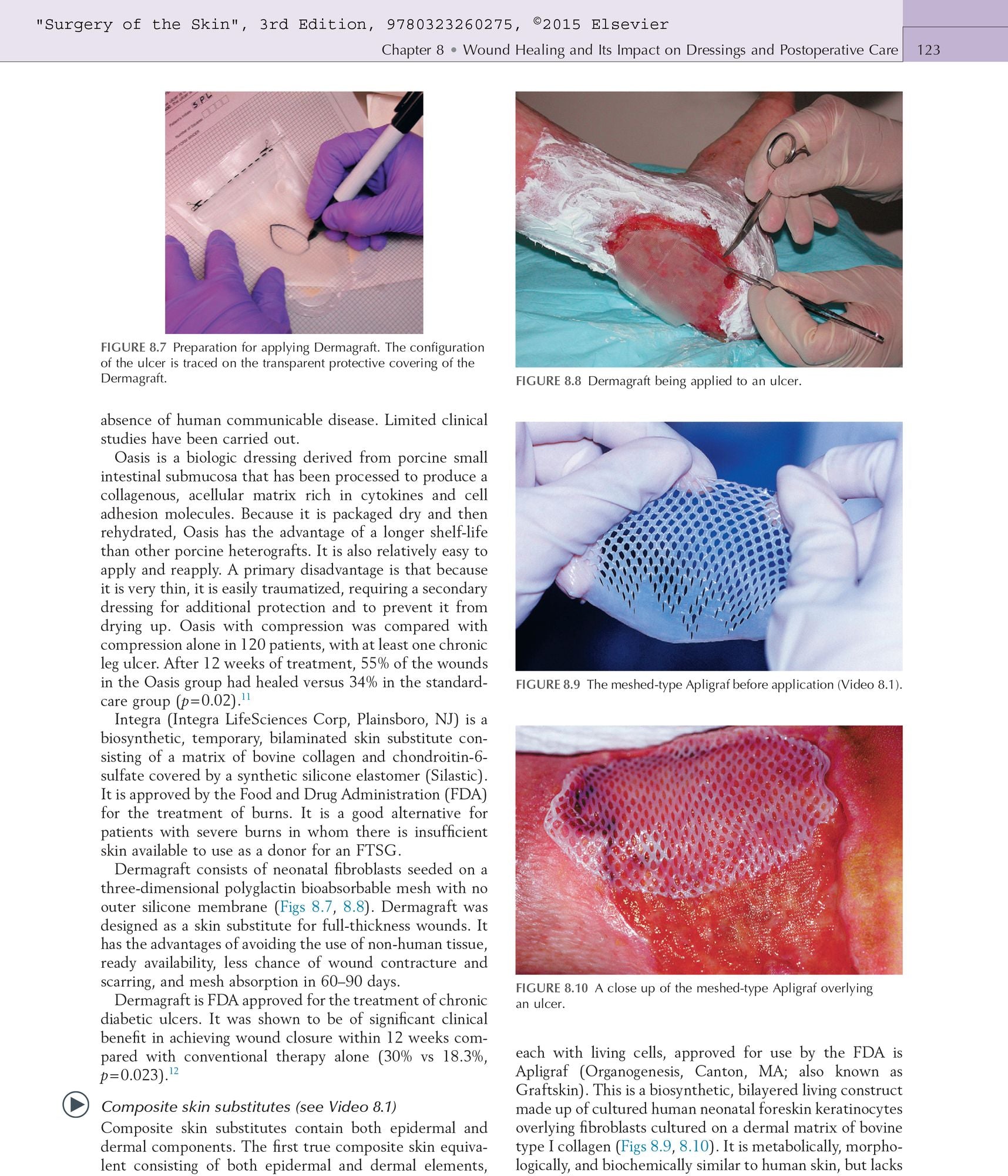 Surgery of the Skin: Procedural Dermatology