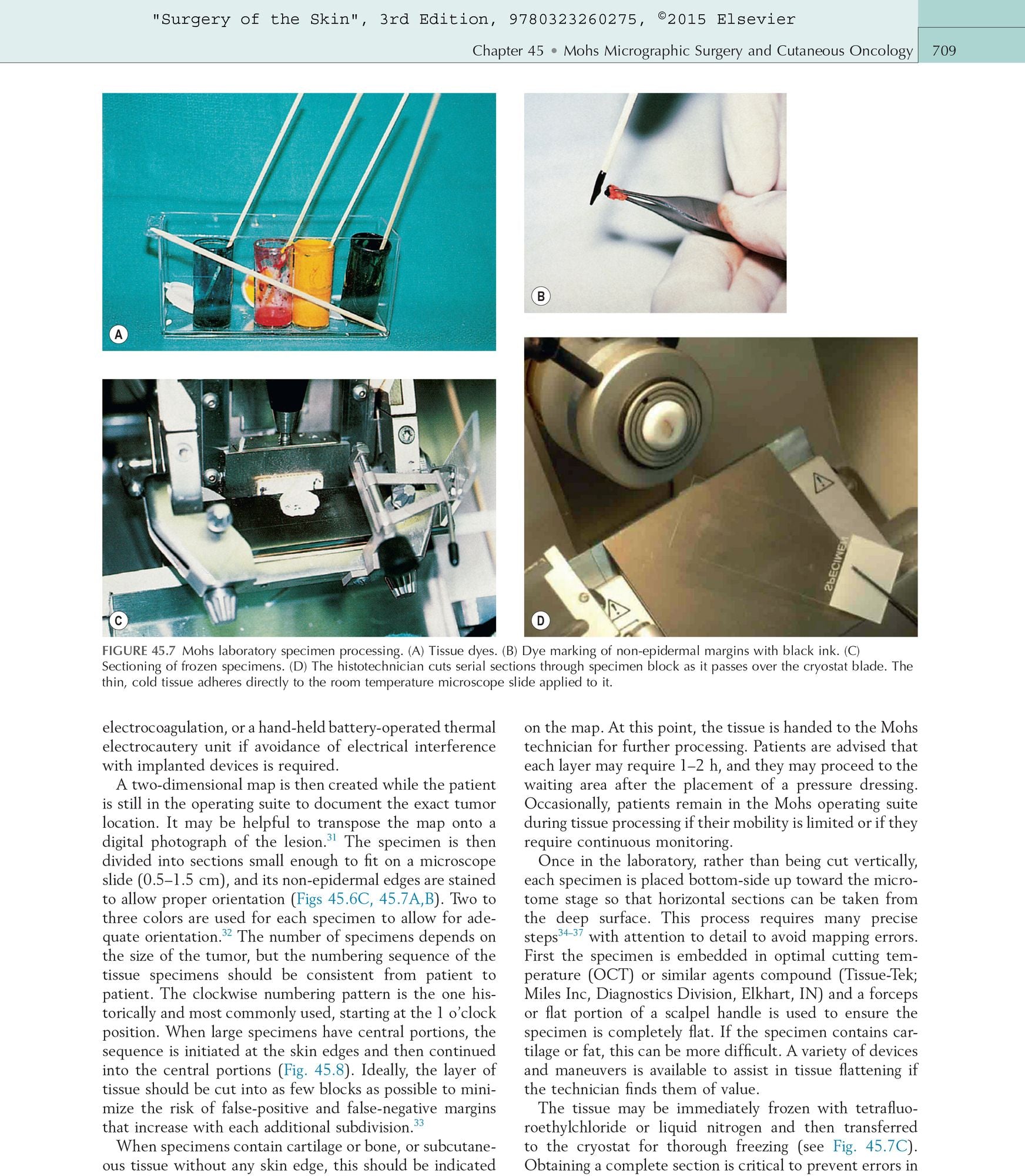 Surgery of the Skin: Procedural Dermatology