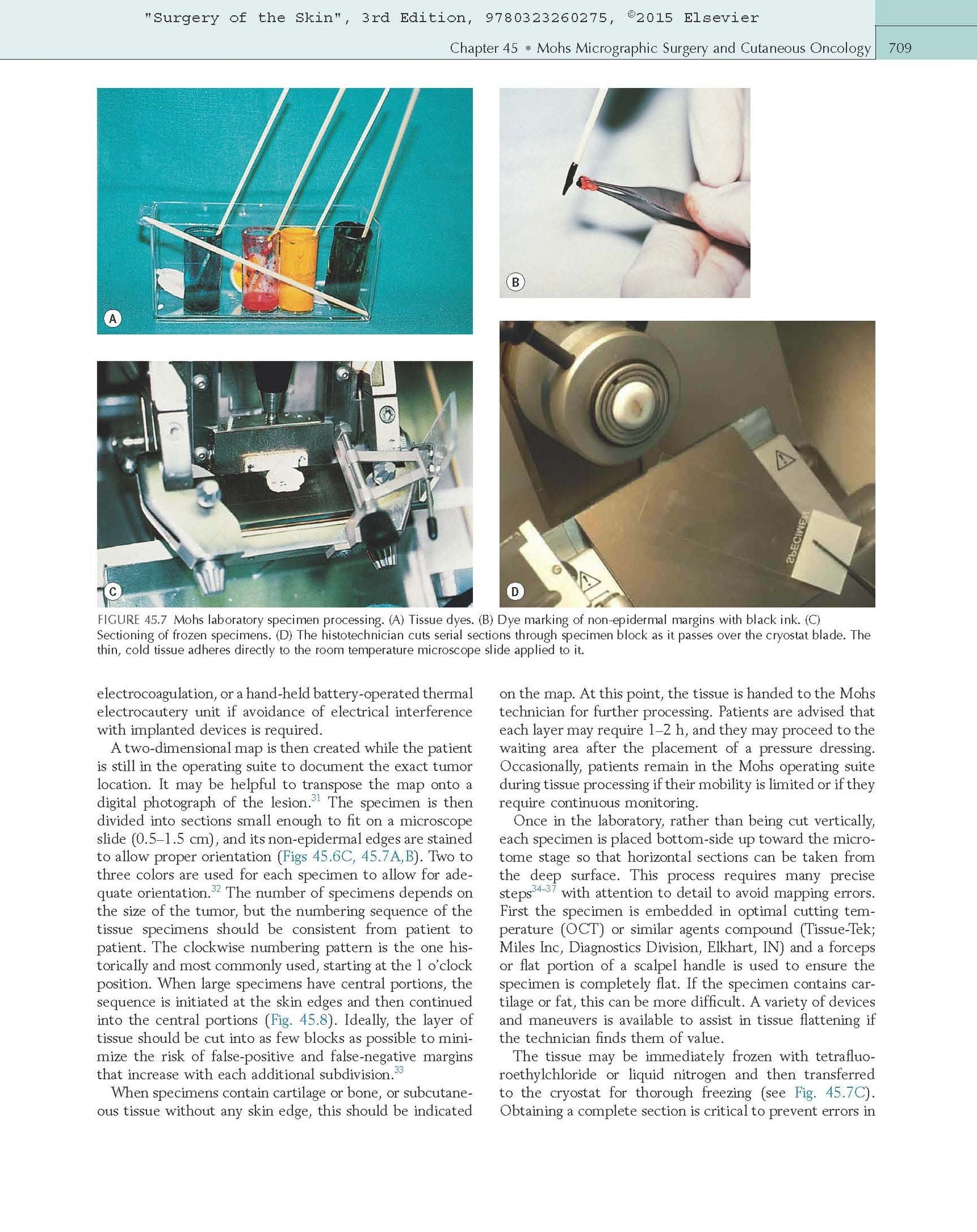 Surgery of the Skin: Procedural Dermatology