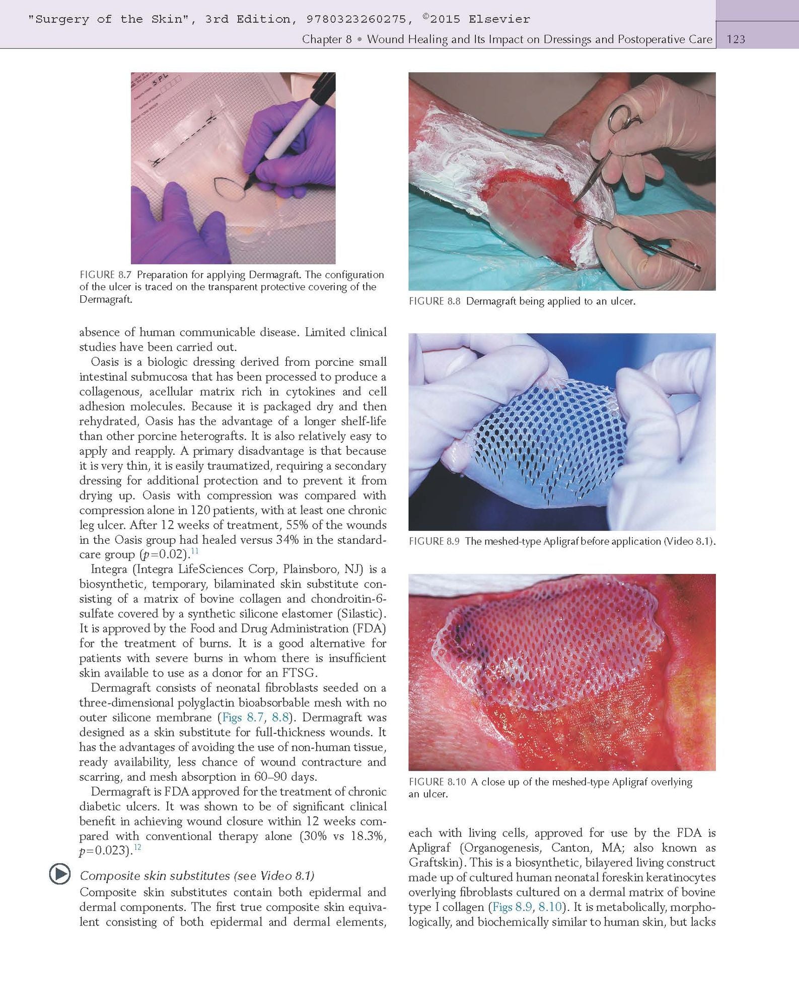 Surgery of the Skin: Procedural Dermatology