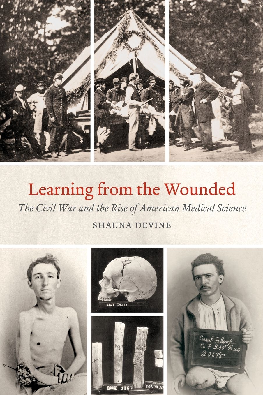 Learning from the Wounded: The Civil War and the Rise of American Medical Science