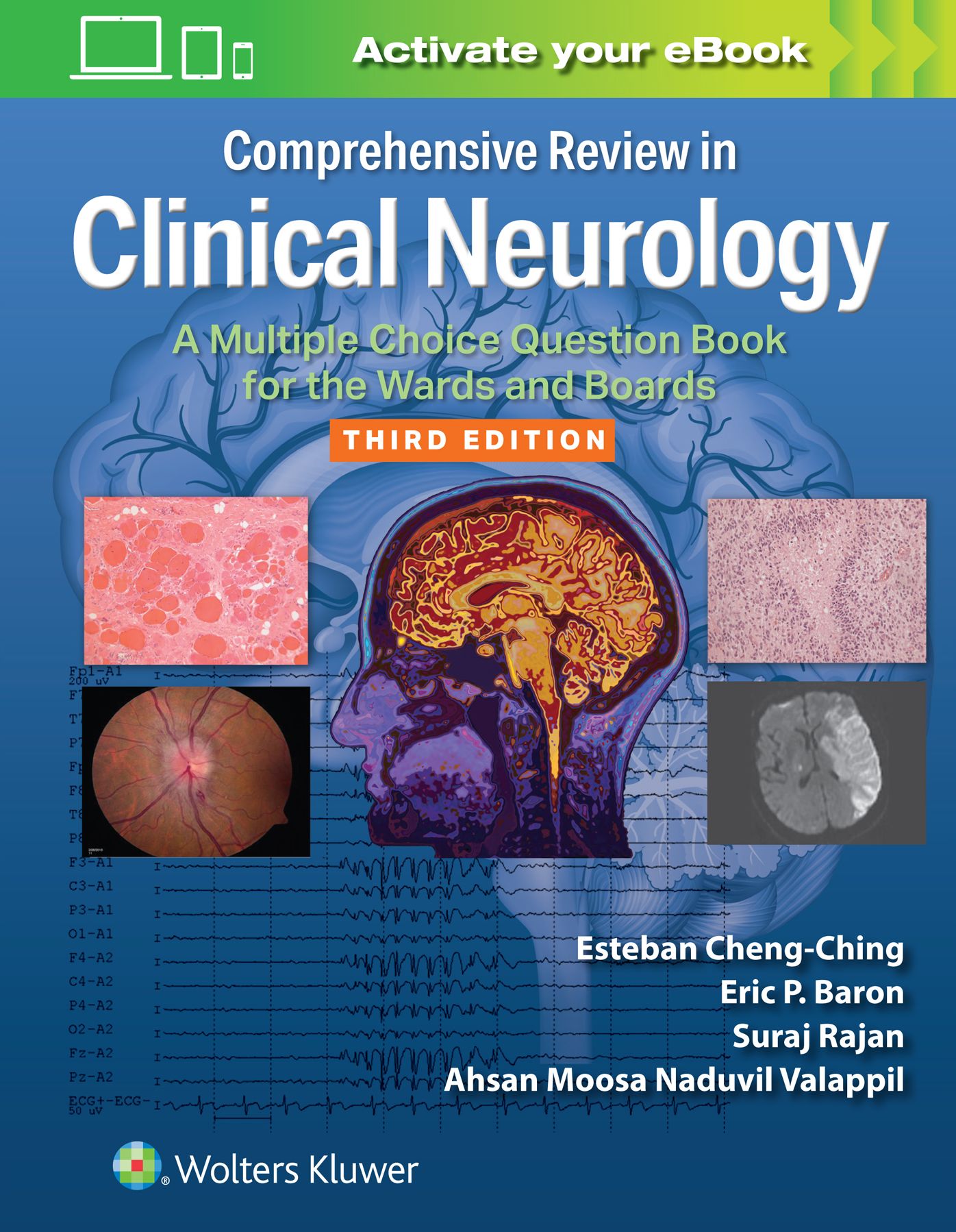 Comprehensive Review in Clinical Neurology: A Multiple Choice Question Book for the Wards and Boards Print + Ebook with Multimedia