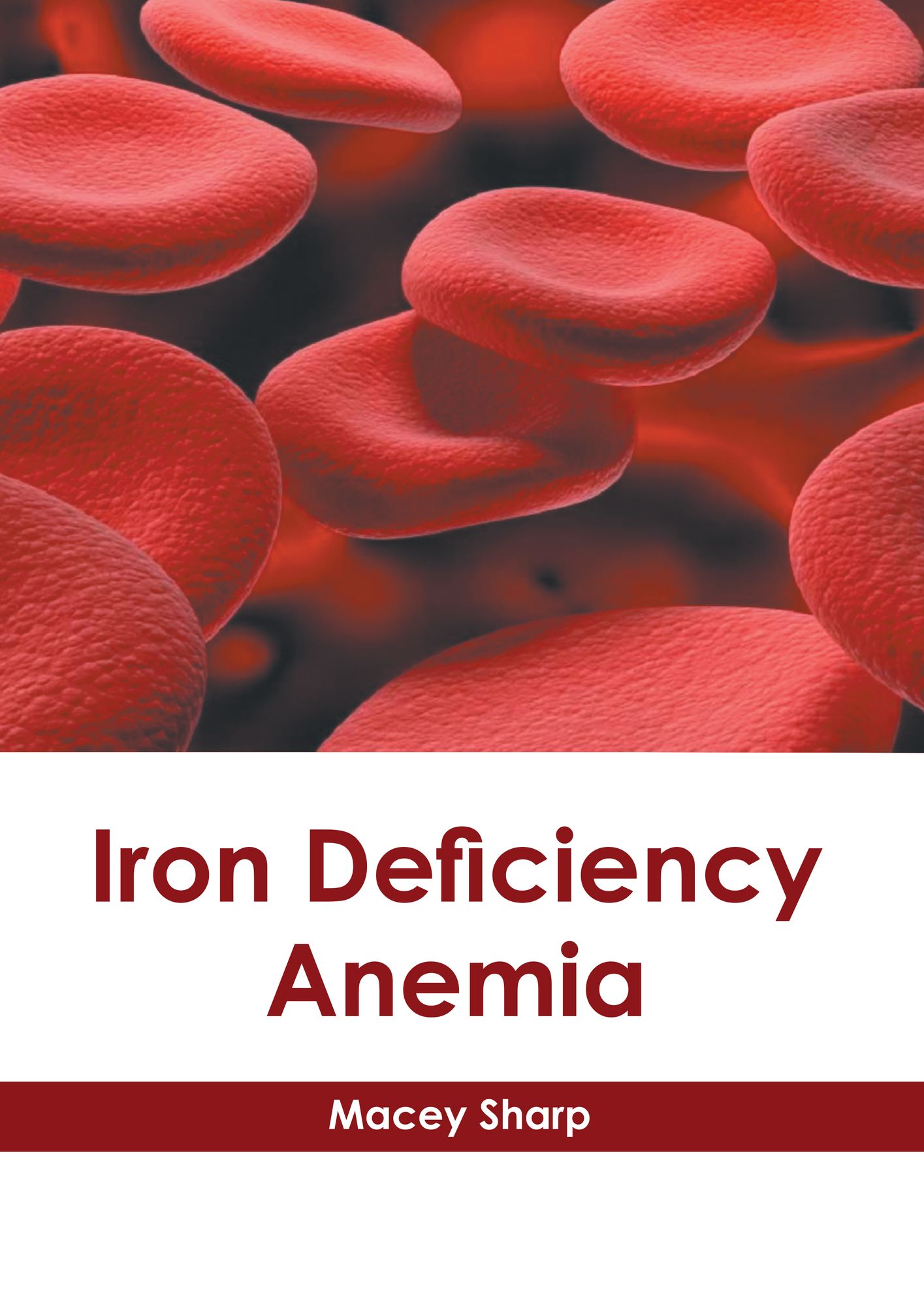 Iron Deficiency Anemia