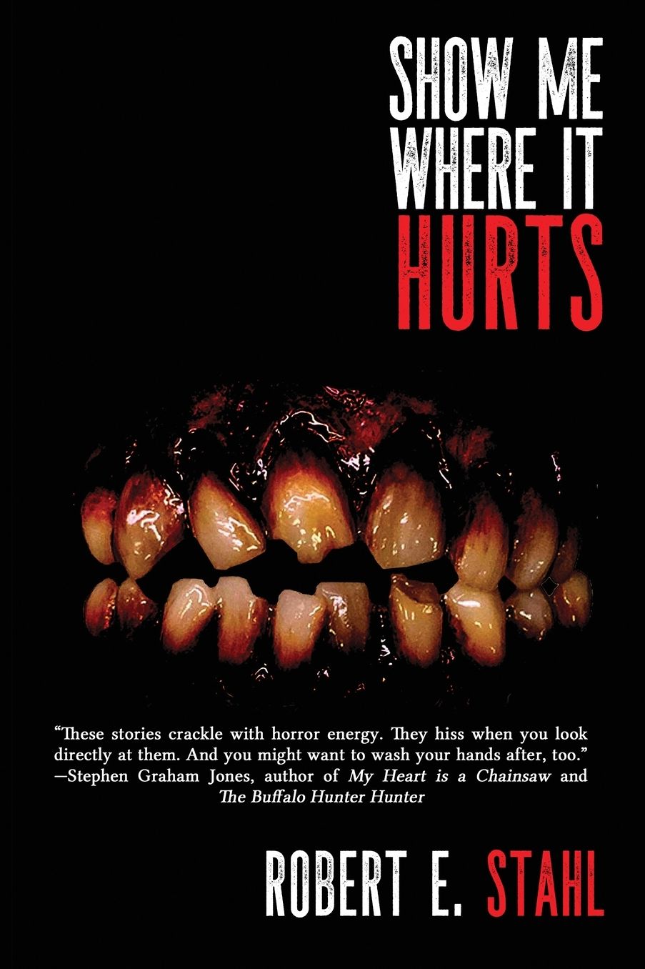 Show Me Where It Hurts